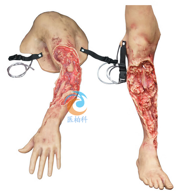 ����ʽ��ѪֹѪģ�MӖ(x��n)����(��֫����֫��