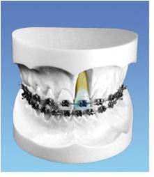 �����z�в۵�����ʾ��ģ��