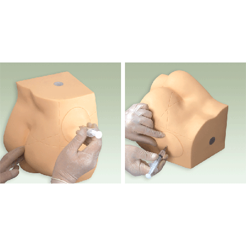 �β�����ע��Ӗ(x��n)��ģ��