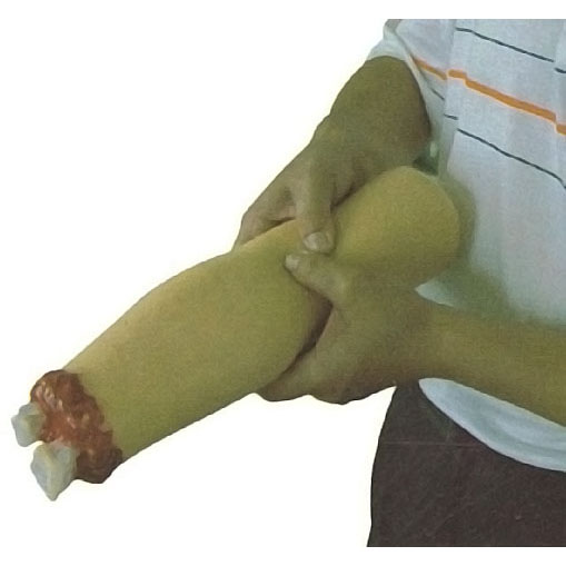 ��֫�����ֹ֫Ѫģ��