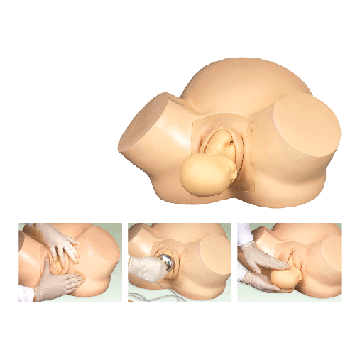 �߼�(j��)���a(ch��n)Ӗ(x��n)��ģ��