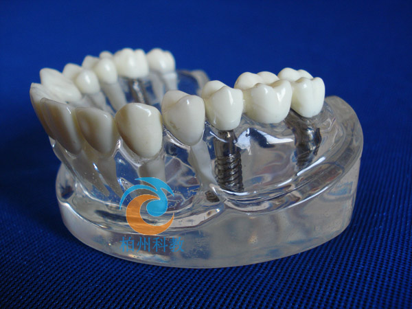 ���w�Nֲ�c�p�w�Nֲ���w�ޏ�(f��)��ʾģ��