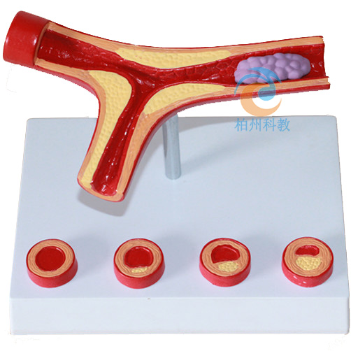 ���wѪ�ܲ�������ģ��