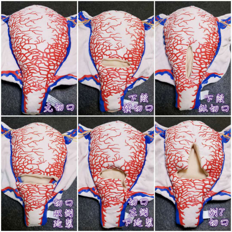 �ӌm���SѪ�ܷ���ܛ�wģ��